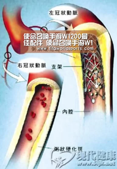 使命召唤手游W1200最佳配件 使命召唤手游W1200皮肤|世界杯直播(图1) 赛事数据